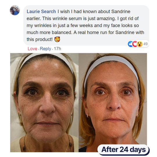 Sandrine™ - The Anti-Wrinkle Serum 3