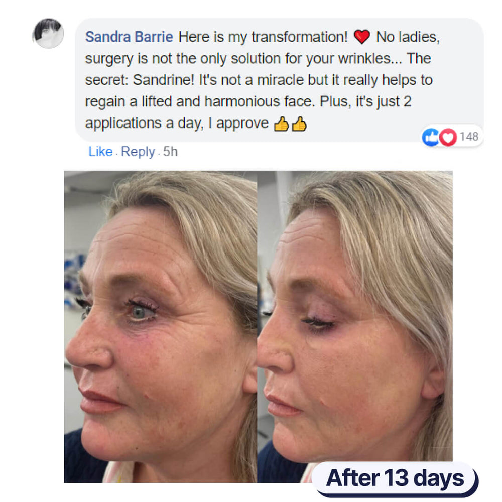 (FREE) The Day Cream Sandrine™