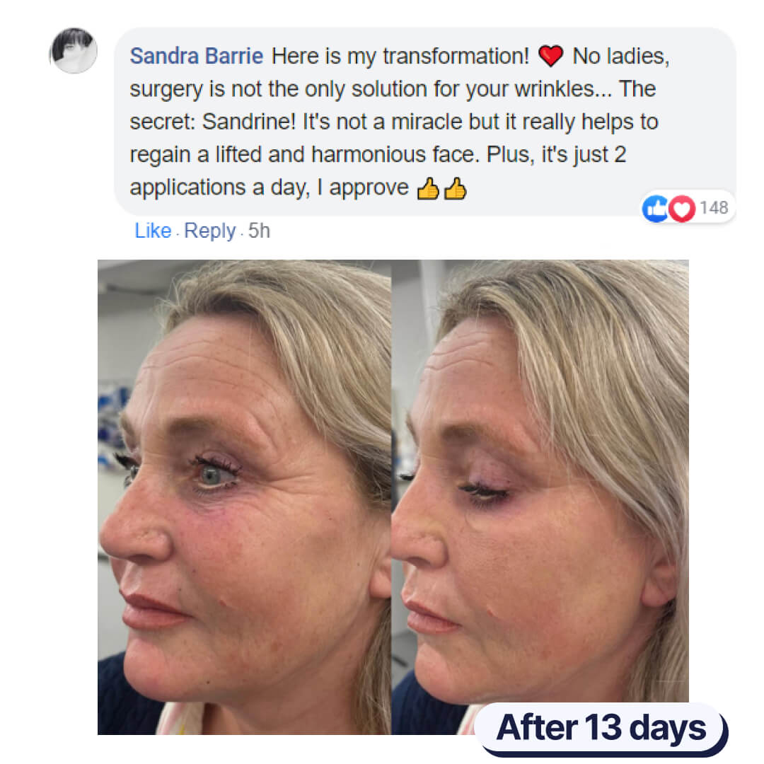 Sandrine™ - The Anti-Wrinkle Serum 3
