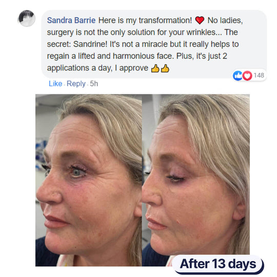 Sandrine™ - The Anti-Wrinkle Serum 3